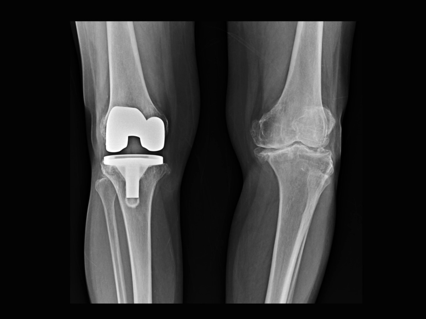 xray image